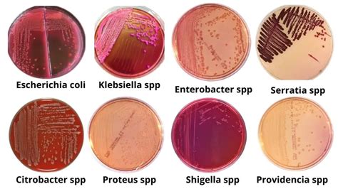 enterobacter macconkey|MacConkey Agar: Composition, Uses, Colony Characteristics .
